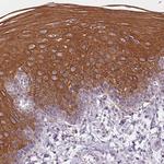 Cytokeratin 6A Polyclonal Antibody