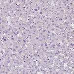 Cytokeratin 6A Antibody in Immunohistochemistry (Paraffin) (IHC (P))