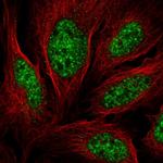 ALY Polyclonal Antibody