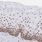 SRSF1 Polyclonal Antibody