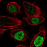 C/EBP beta Antibody in Immunocytochemistry (ICC/IF)