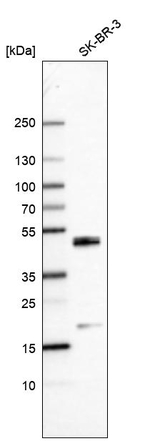 C/EBP beta Antibody in Western Blot (WB)