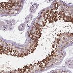 TTC12 Antibody in Immunohistochemistry (Paraffin) (IHC (P))
