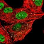 CLEC16A Polyclonal Antibody