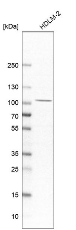 CLEC16A Antibody in Western Blot (WB)