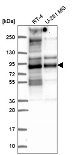 TACC2 Antibody in Western Blot (WB)