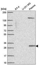SCML1 Antibody in Western Blot (WB)