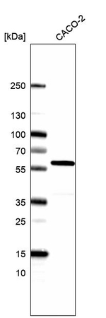 Cyclin B1 Antibody in Western Blot (WB)