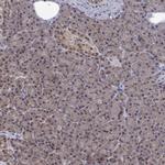 ALS2CR1 Polyclonal Antibody