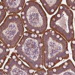 NLRX1 Antibody in Immunohistochemistry (Paraffin) (IHC (P))