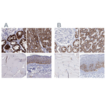 MCCC2 Antibody in Immunohistochemistry (Paraffin) (IHC (P))