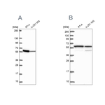 MCCC2 Antibody in Western Blot (WB)