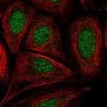 CCDC61 Antibody in Immunocytochemistry (ICC/IF)