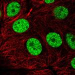 TAP Polyclonal Antibody