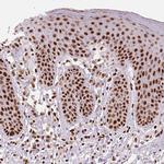 TAP Antibody in Immunohistochemistry (Paraffin) (IHC (P))