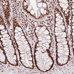 TAP Antibody in Immunohistochemistry (Paraffin) (IHC (P))