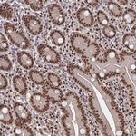 GTF2B Antibody in Immunohistochemistry (Paraffin) (IHC (P))