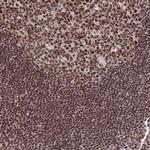GTF2B Antibody in Immunohistochemistry (Paraffin) (IHC (P))