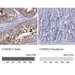 CYB5R2 Antibody