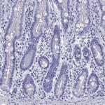 CYB5R2 Polyclonal Antibody