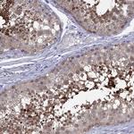 CYB5R2 Antibody in Immunohistochemistry (Paraffin) (IHC (P))