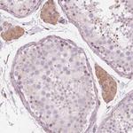 BRSK1 Polyclonal Antibody