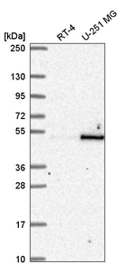RBMS1 Antibody in Western Blot (WB)