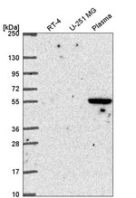 SPRED1 Antibody in Western Blot (WB)