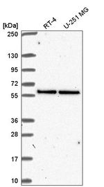 UBXN6 Antibody in Western Blot (WB)