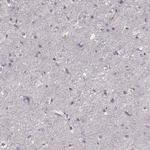PMCH Antibody in Immunohistochemistry (Paraffin) (IHC (P))