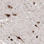 PMCH Antibody in Immunohistochemistry (Paraffin) (IHC (P))