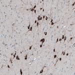 PMCH Antibody in Immunohistochemistry (Paraffin) (IHC (P))