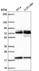 NUP85 Antibody in Western Blot (WB)