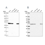 NDUFS2 Antibody in Western Blot (WB)