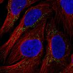 RyR3 Polyclonal Antibody