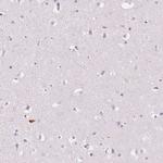 Kallikrein 7 Antibody in Immunohistochemistry (Paraffin) (IHC (P))