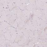 Kallikrein 7 Antibody in Immunohistochemistry (Paraffin) (IHC (P))