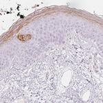 Kallikrein 7 Antibody in Immunohistochemistry (Paraffin) (IHC (P))