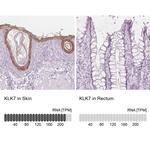Kallikrein 7 Antibody