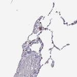 SFTPB Antibody in Immunohistochemistry (Paraffin) (IHC (P))
