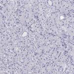 SFTPB Antibody in Immunohistochemistry (Paraffin) (IHC (P))