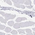 SFTPB Antibody in Immunohistochemistry (Paraffin) (IHC (P))