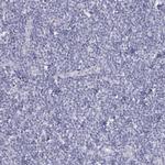 SFTPB Antibody in Immunohistochemistry (Paraffin) (IHC (P))