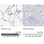 SFTPB Antibody