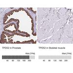 TPD52 Antibody