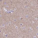 TPD52 Antibody in Immunohistochemistry (Paraffin) (IHC (P))