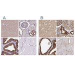 TPD52 Antibody in Immunohistochemistry (Paraffin) (IHC (P))