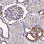 TPD52 Antibody in Immunohistochemistry (Paraffin) (IHC (P))