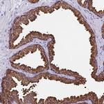 TPD52 Antibody in Immunohistochemistry (Paraffin) (IHC (P))