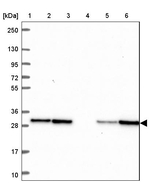 TPD52 Antibody in Western Blot (WB)